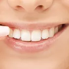 セルフホワイトニング